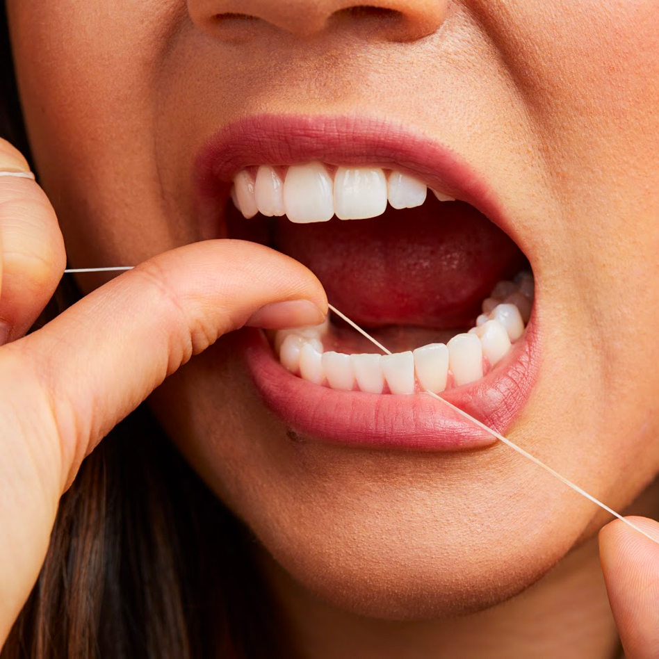 Plaque and your teeth - Waverley Oaks Dental
